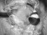 Talgoxe